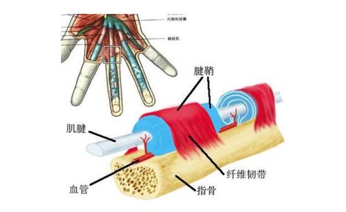 云南腱鞘炎怎么治疗