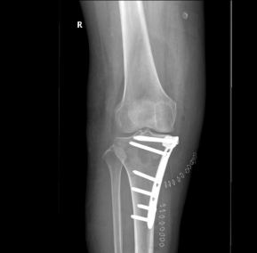 1513511226712790.png 图片11.png