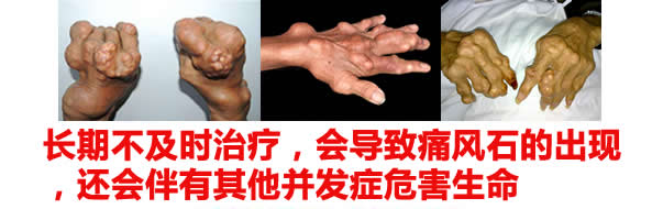 1-1P419114544H5.jpg